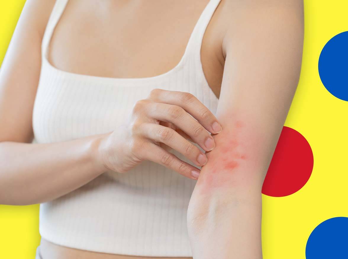 Tratamento do eczema
